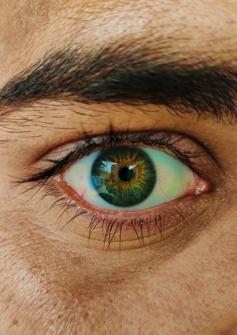 Beyond monetary benefits of restoring sight in Vietnam: Evaluating well-being gains from cataract surgery